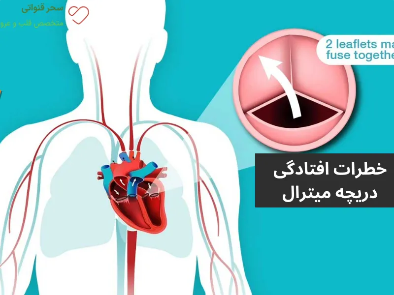 افتادگی دریچه میترال خطرناک است؟