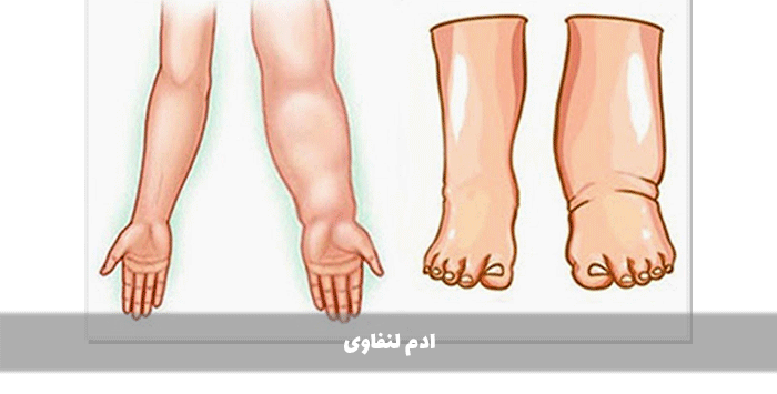ادم لنفاوی