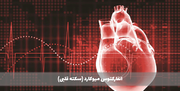  انفارکتوس میوکارد (سکته قلبی)