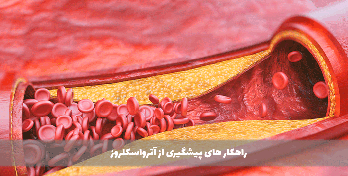 راهکار های پیشگیری از آترواسکلروز

