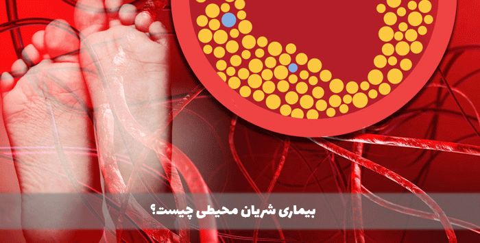 بیماری شریان محیطی چیست؟