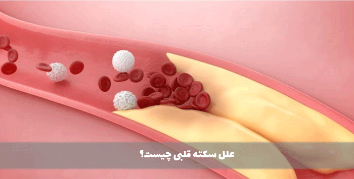 علل سکته قلبی چیست؟