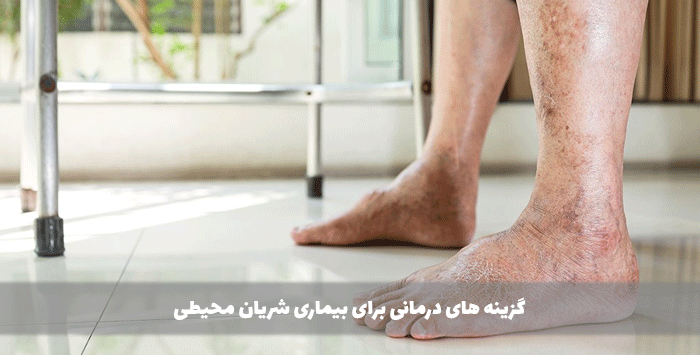 گزینه های درمانی برای بیماری شریان محیطی
