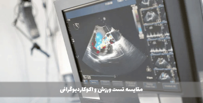 مقایسه مستقیم بین تست ورزش و اکوکاردیوگرافی