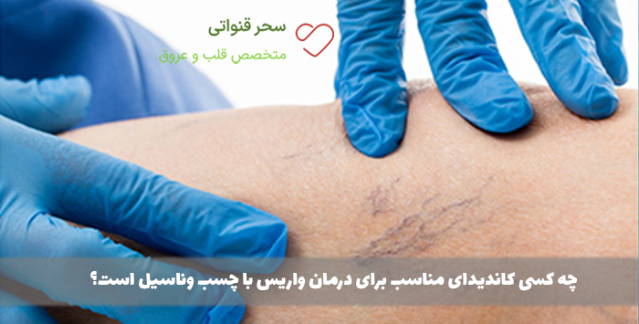 چه کسی کاندیدای مناسب برای درمان واریس با چسب وناسیل است؟