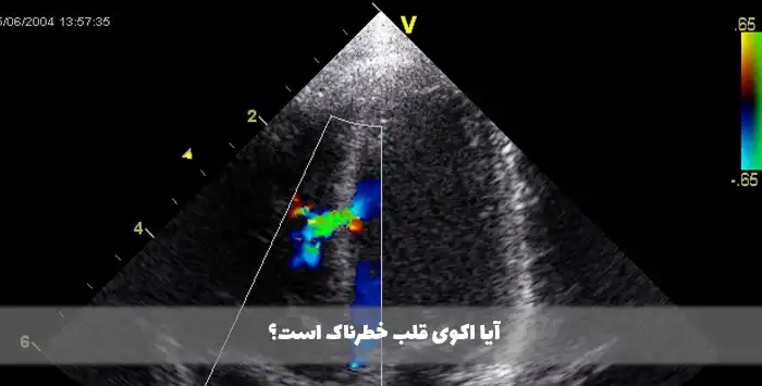 آیا اکوی قلب خطرناک است؟