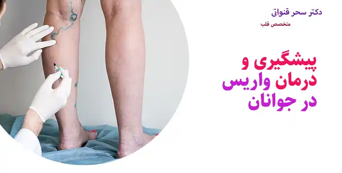 پیشگیری و درمان واریس در جوانان